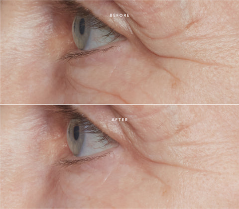 Before and after skin results