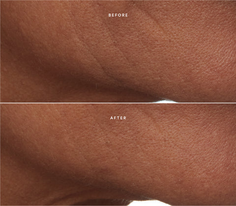 Before and after skin results